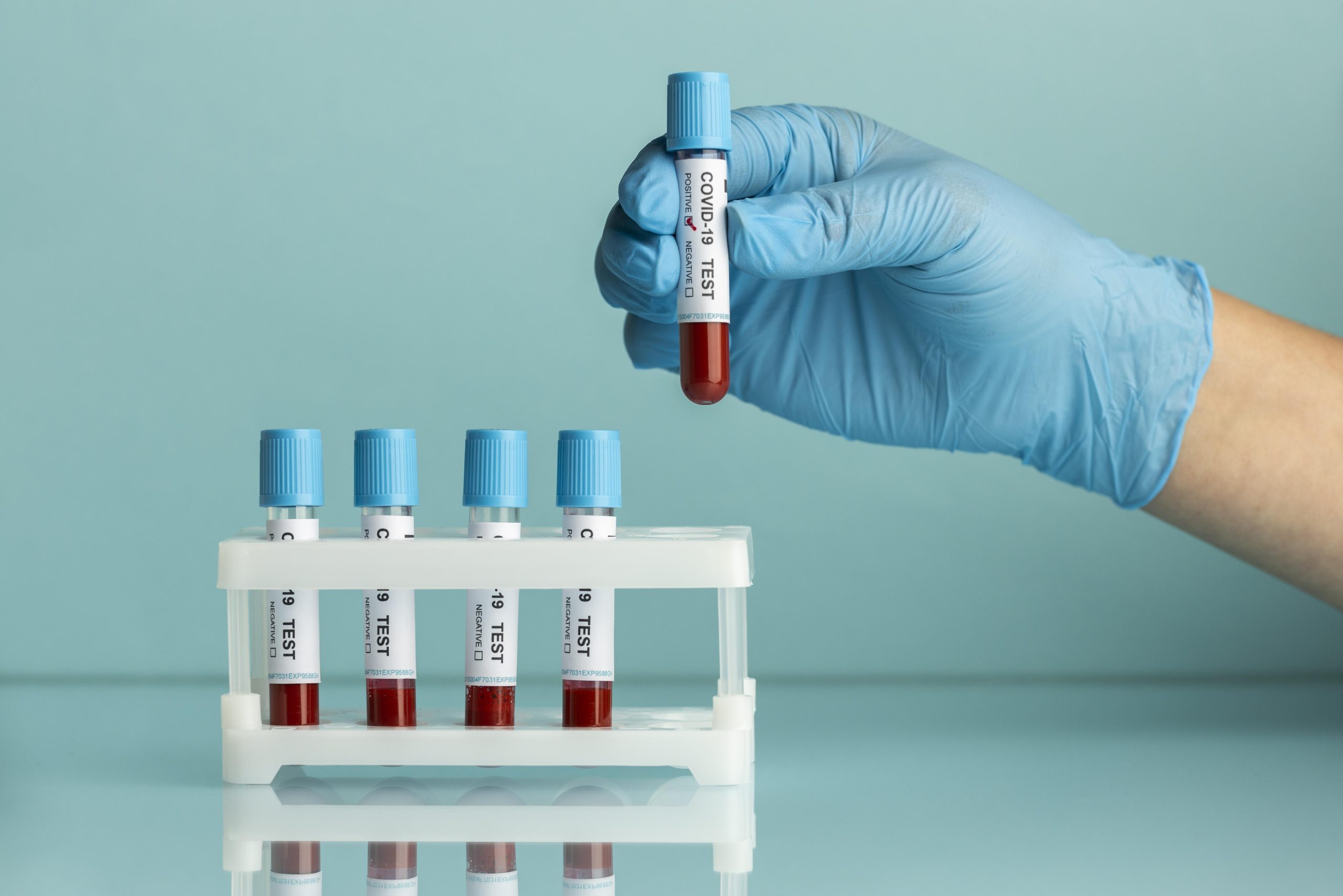 Book CBC Blood Test at Home Nashik – Medola