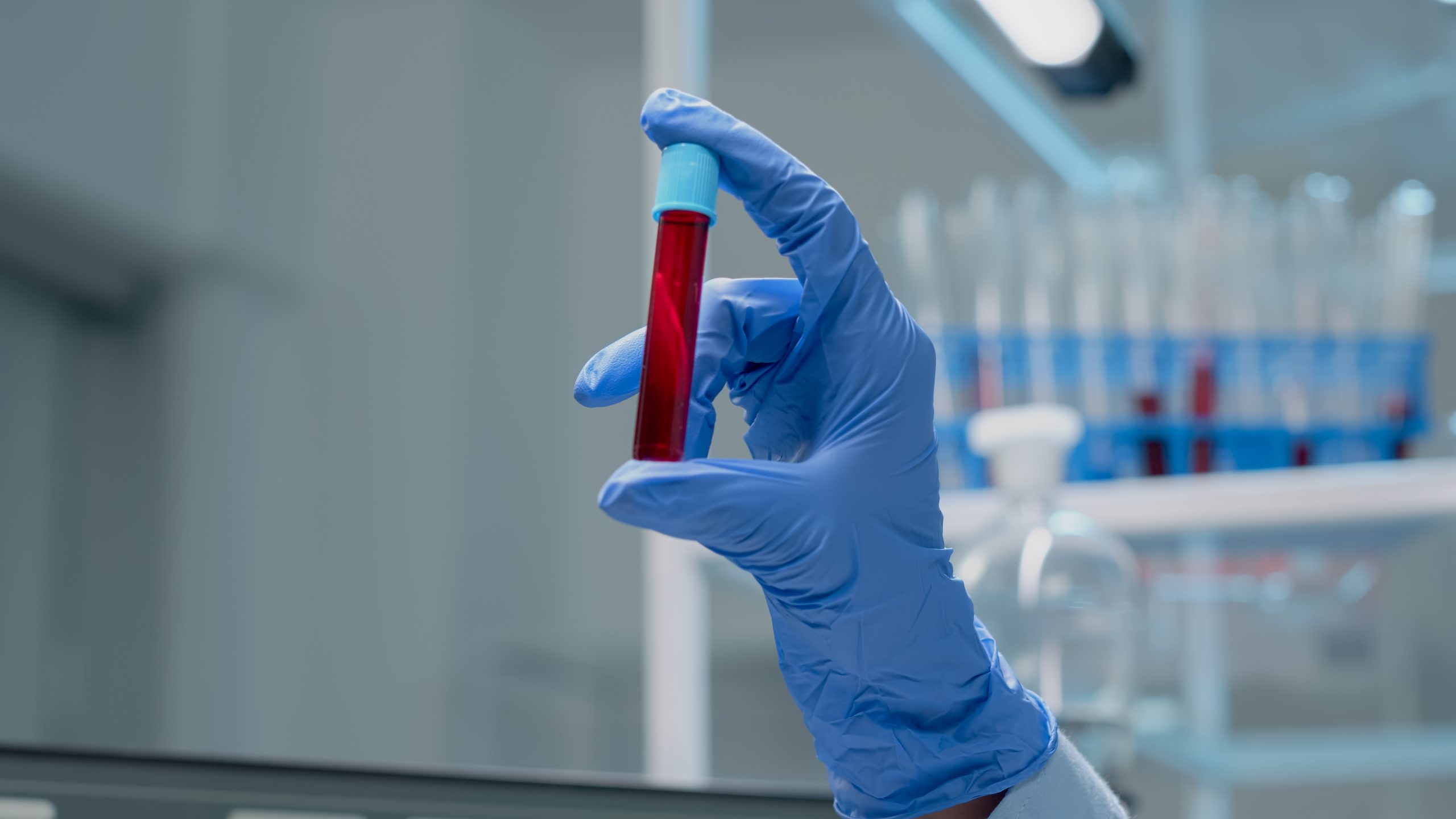 NABL Certified Iron Test at Home – Medola Nashik